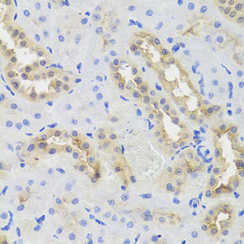 Immunohistochemistry - DISC1 Polyclonal Antibody 