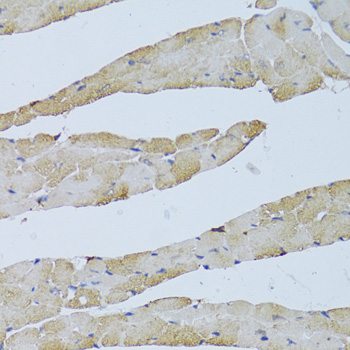 Immunohistochemistry - TRAP1 Polyclonal Antibody 