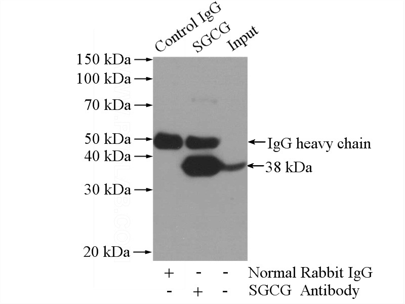 IP Result of anti-SGCG (IP:Catalog No:115163, 4ug; Detection:Catalog No:115163 1:1000) with mouse heart tissue lysate 4000ug.
