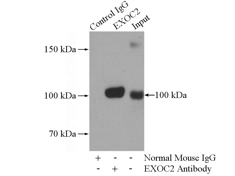 IP Result of anti-SEC5 (IP:Catalog No:107522, 5ug; Detection:Catalog No:107522 1:500) with mouse brain tissue lysate 3440ug.