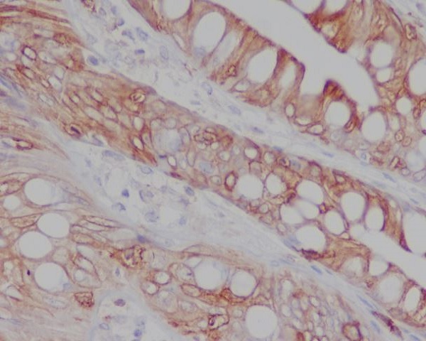 Immunohistochemical analysis of paraffin-embedded human colon, using CD8 Antibody.