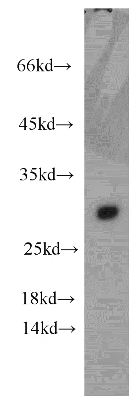 human blood tissue were subjected to SDS PAGE followed by western blot with Catalog No:108037(APOA1 antibody) at dilution of 1:1000