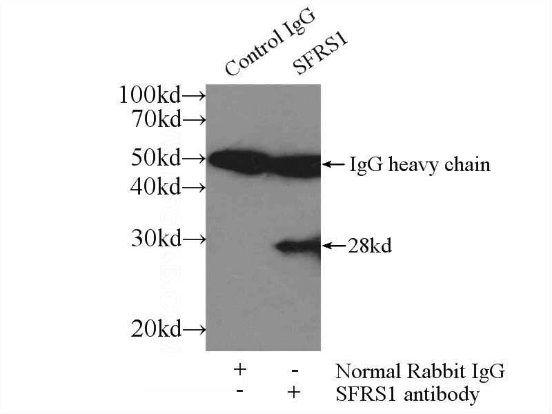 IP Result of anti-ASF/SF2 (IP:Catalog No:108221, 3ug; Detection:Catalog No:108221 1:500) with mouse brain tissue lysate 3600ug.