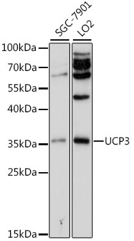Western blot - UCP3 Polyclonal Antibody 