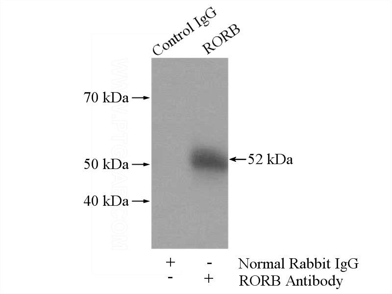 IP Result of anti-RORB (IP:Catalog No:114789, 4ug; Detection:Catalog No:114789 1:300) with mouse brain tissue lysate 3440ug.