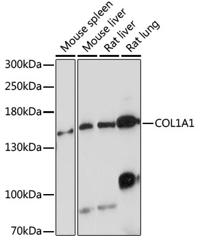 Western blot - COL1A1 Polyclonal Antibody 
