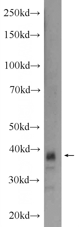 mouse heart tissue were subjected to SDS PAGE followed by western blot with Catalog No:109723(CTGF Antibody) at dilution of 1:600