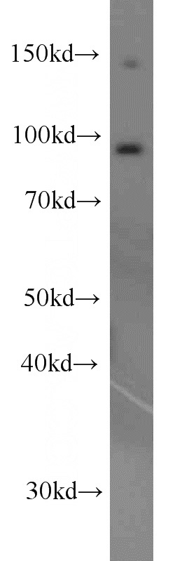 HeLa cells were subjected to SDS PAGE followed by western blot with Catalog No:110185(EIF2C1-Specific antibody) at dilution of 1:1000