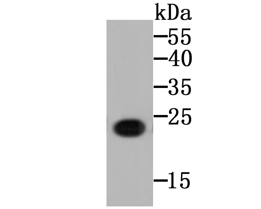 Fig1: Western blot analysis of CD130 on CD130 recombinant protein using anti-CD130 antibody at 1/5,000 dilution.