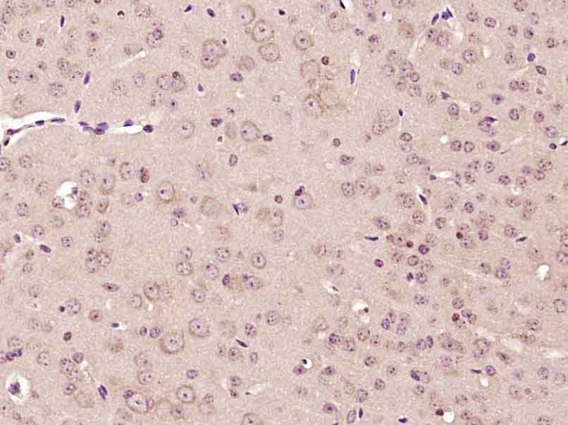 Fig1: Paraformaldehyde-fixed, paraffin embedded (Mouse brain); Antigen retrieval by boiling in sodium citrate buffer (pH6.0) for 15min; Block endogenous peroxidase by 3% hydrogen peroxide for 20 minutes; Blocking buffer (normal goat serum) at 37℃ for 30min; Antibody incubation with (CHST7) Polyclonal Antibody, Unconjugated at 1:400 overnight at 4℃, followed by operating according to SP Kit(Rabbit) (sp-0023) instructionsand DAB staining.