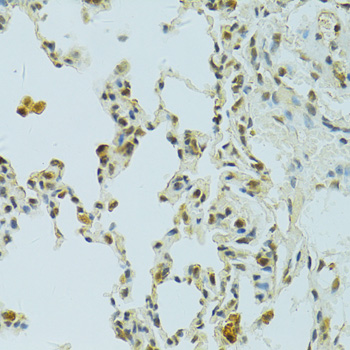 Immunohistochemistry - RSRC1 Polyclonal Antibody 