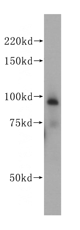 human heart tissue were subjected to SDS PAGE followed by western blot with Catalog No:114398(PSMD2 antibody) at dilution of 1:500