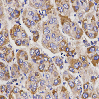 Immunohistochemistry - UGT1A9 Polyclonal Antibody 