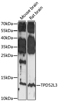 Western blot - TPD52L3 Polyclonal Antibody 