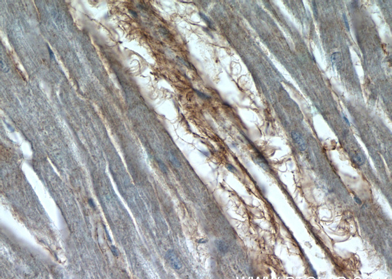 Immunohistochemistry of paraffin-embedded human heart tissue slide using Catalog No:109990(SAP 97 Antibody) at dilution of 1:50 (under 40x lens)
