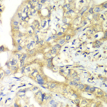 Immunohistochemistry - TIMM17A Polyclonal Antibody 