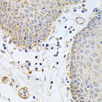 Immunohistochemistry - GP2 Polyclonal Antibody 