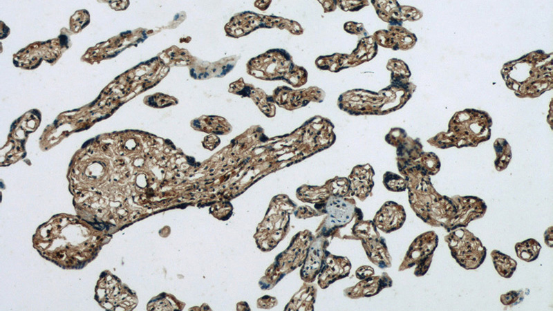 Immunohistochemistry of paraffin-embedded human placenta tissue slide using Catalog No:116409(TRPC6 Antibody) at dilution of 1:50 (under 10x lens)