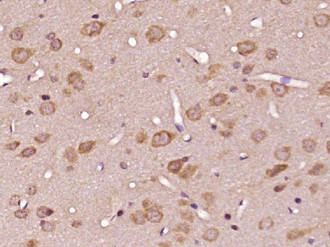 Fig2: Paraformaldehyde-fixed, paraffin embedded (Rat brain); Antigen retrieval by boiling in sodium citrate buffer (pH6.0) for 15min; Block endogenous peroxidase by 3% hydrogen peroxide for 20 minutes; Blocking buffer (normal goat serum) at 37℃ for 30min; Antibody incubation with (IGF I) Polyclonal Antibody, Unconjugated at 1:400 overnight at 4℃, followed by operating according to SP Kit(Rabbit) (sp-0023) instructionsand DAB staining.