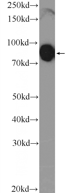 Jurkat cells were subjected to SDS PAGE followed by western blot with Catalog No:111908(KANK1 Antibody) at dilution of 1:1000