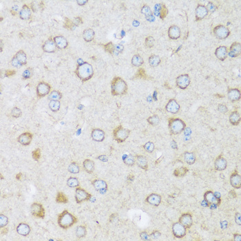 Immunohistochemistry - BRSK1 Polyclonal Antibody 