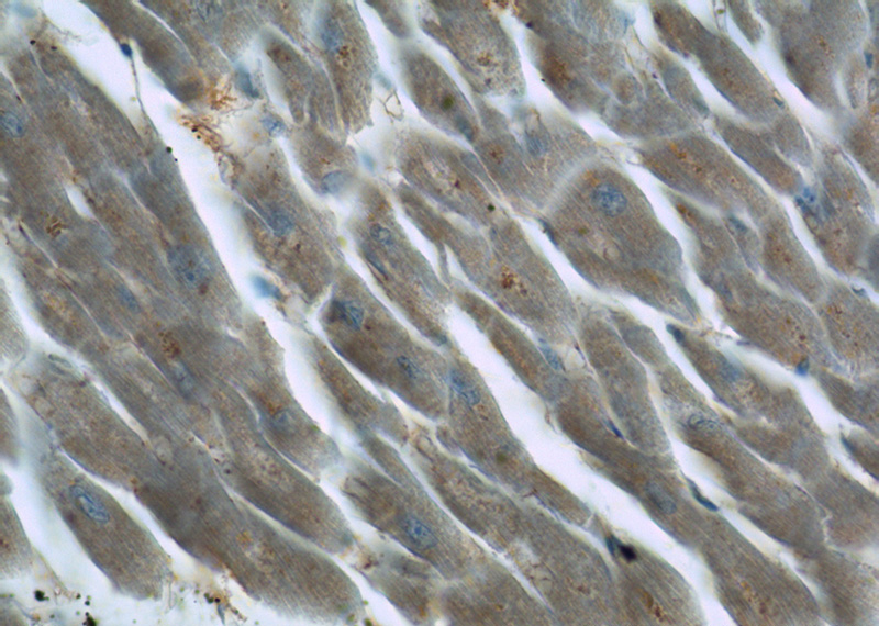 Immunohistochemistry of paraffin-embedded human heart tissue slide using Catalog No:110553(FBXO32 Antibody) at dilution of 1:50 (under 40x lens)