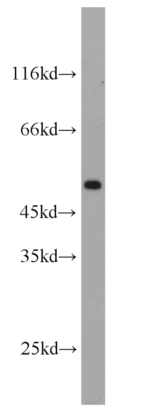 mouse brain tissue were subjected to SDS PAGE followed by western blot with Catalog No:108808(CA9 antibody) at dilution of 1:300