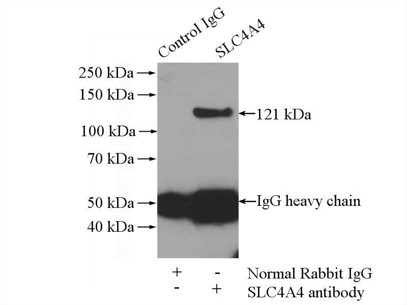 IP Result of anti-SLC4A4 (IP:Catalog No:115341, 4ug; Detection:Catalog No:115341 1:400) with HEK-293 cells lysate 1200ug.