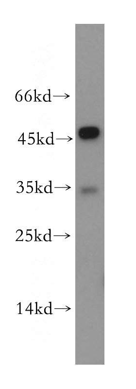 HeLa cells were subjected to SDS PAGE followed by western blot with Catalog No:116765(VN1R4 antibody) at dilution of 1:500