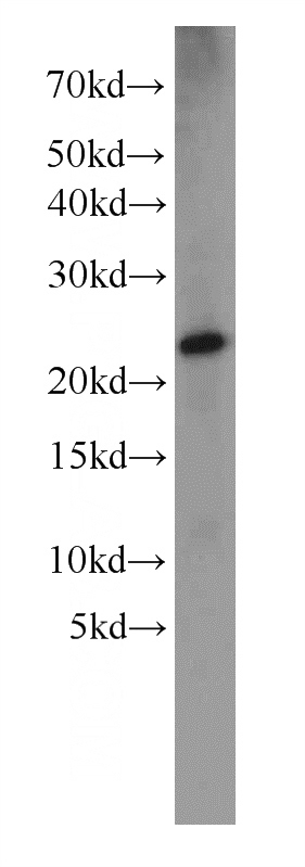 rat skin tissue were subjected to SDS PAGE followed by western blot with Catalog No:109895(DPT antibody) at dilution of 1:1000
