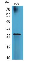 Fig1:; Western Blot analysis of PC12 cells using POLR3G Polyclonal Antibody.. Secondary antibody（catalog#：HA1001) was diluted at 1:20000 cells nucleus extracted by Minute TM Cytoplasmic and Nuclear Fractionation kit (SC-003,Inventbiotech,MN,USA).