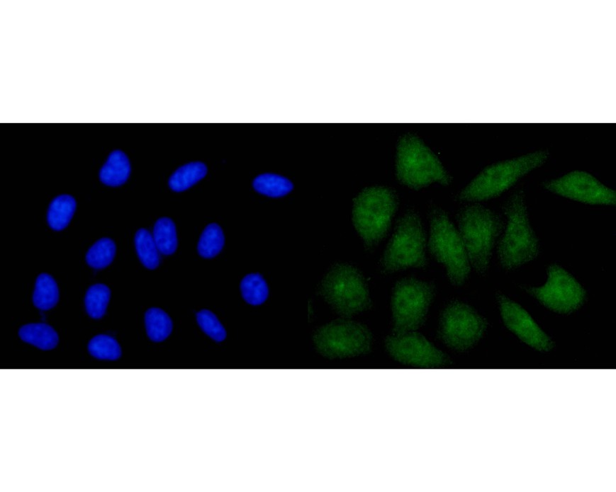 Fig3:; ICC staining of CLIC2 in HepG2 cells (green). Formalin fixed cells were permeabilized with 0.1% Triton X-100 in TBS for 10 minutes at room temperature and blocked with 10% negative goat serum for 15 minutes at room temperature. Cells were probed with the primary antibody ( 1/50) for 1 hour at room temperature, washed with PBS. Alexa Fluor®488 conjugate-Goat anti-Mouse IgG was used as the secondary antibody at 1/1,000 dilution. The nuclear counter stain is DAPI (blue).