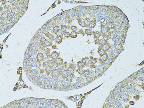 Immunohistochemistry - PSMF1 Polyclonal Antibody 