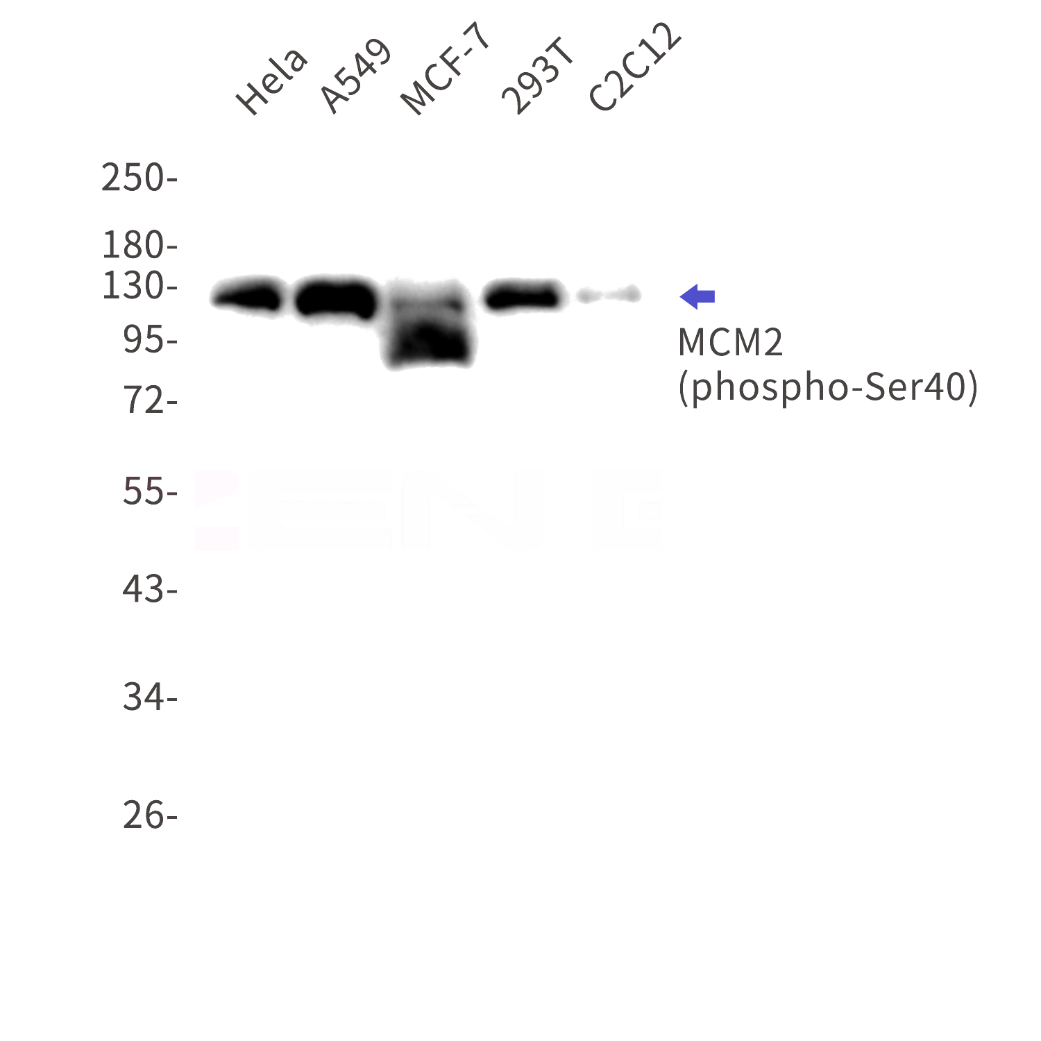 Western blot detection of phospho-MCM2(Ser40) in Hela,A549,MCF-7,293T,C2C12 cell lysates using phospho-MCM2(Ser40) Rabbit mAb(1:1000 diluted).Predicted band size:102kDa.Observed band size:125kDa.