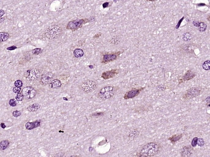 Fig2: Paraformaldehyde-fixed, paraffin embedded (Rat brain); Antigen retrieval by boiling in sodium citrate buffer (pH6.0) for 15min; Block endogenous peroxidase by 3% hydrogen peroxide for 20 minutes; Blocking buffer (normal goat serum) at 37℃ for 30min; Antibody incubation with (RNF128) Polyclonal Antibody, Unconjugated at 1:400 overnight at 4℃, followed by operating according to SP Kit(Rabbit) (sp-0023) instructionsand DAB staining.