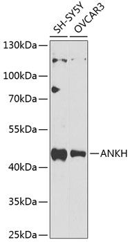 Western blot - ANKH Polyclonal Antibody 
