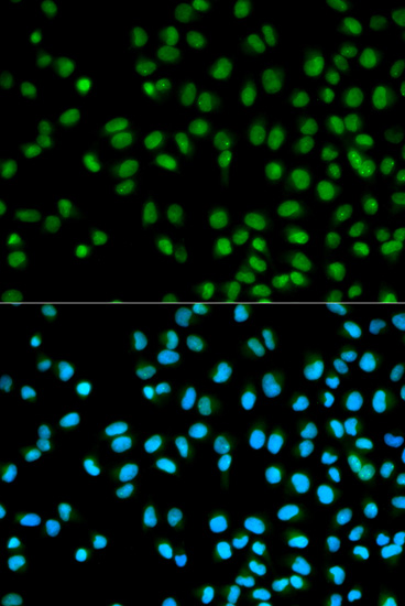 Immunofluorescence - CST8 Polyclonal Antibody 