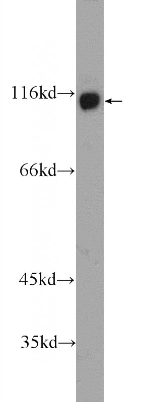 Jurkat cells were subjected to SDS PAGE followed by western blot with Catalog No:111889(JMY Antibody) at dilution of 1:1000