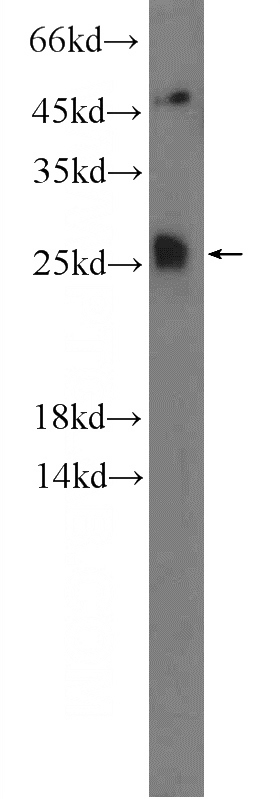 mouse brain tissue were subjected to SDS PAGE followed by western blot with Catalog No:116176(TMEM208 Antibody) at dilution of 1:300