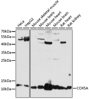 Western blot - COX5A Polyclonal Antibody 
