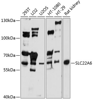 Western blot - SLC22A6 Polyclonal Antibody 
