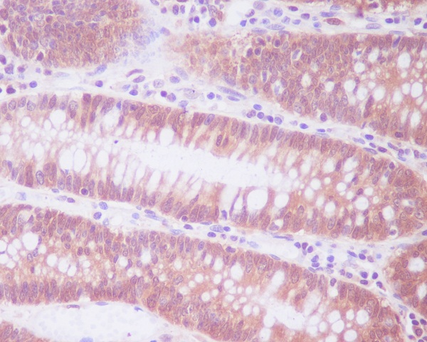 Immunohistochemical analysis of paraffin-embedded human colon, using ENO1 Antibody.