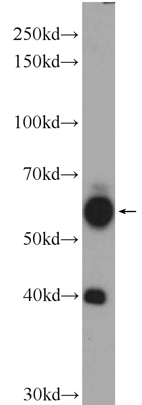 mouse brain tissue were subjected to SDS PAGE followed by western blot with Catalog No:113007(N4BP3 Antibody) at dilution of 1:600