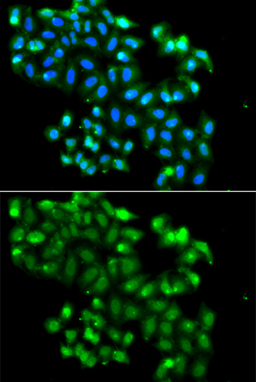 Immunofluorescence - PHF11 Polyclonal Antibody 