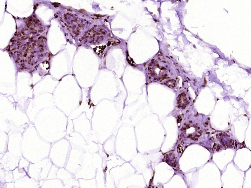 Fig1: Paraformaldehyde-fixed, paraffin embedded (Rat breast); Antigen retrieval by boiling in sodium citrate buffer (pH6.0) for 15min; Block endogenous peroxidase by 3% hydrogen peroxide for 20 minutes; Blocking buffer (normal goat serum) at 37℃ for 30min; Antibody incubation with (BarX2) Polyclonal Antibody, Unconjugated at 1:400 overnight at 4℃, followed by operating according to SP Kit(Rabbit) (sp-0023) instructionsand DAB staining.