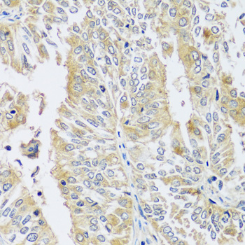Immunohistochemistry - BLOC1S3 Polyclonal Antibody 
