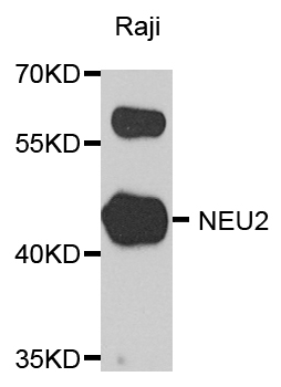 Western blot - NEU2 Polyclonal Antibody 