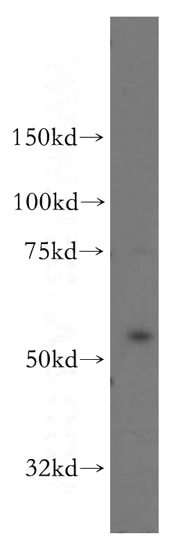 HeLa cells were subjected to SDS PAGE followed by western blot with Catalog No:113529(OXSR1 antibody) at dilution of 1:500