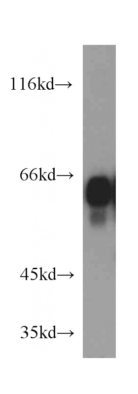 mouse brain tissue were subjected to SDS PAGE followed by western blot with Catalog No:111580(PTPRN antibody) at dilution of 1:300