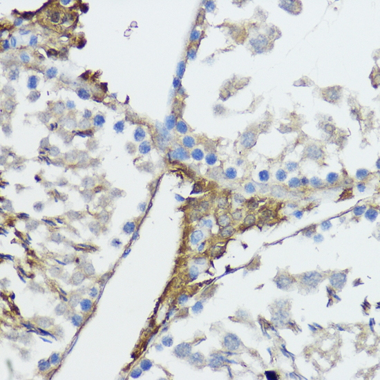 Immunohistochemistry - NOD1 Polyclonal Antibody 